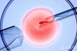 多囊卵巢综合症能做试管婴儿吗