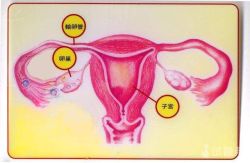 卵巢囊肿怎么办？