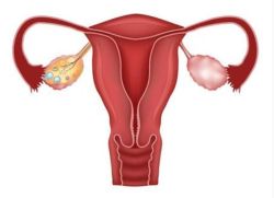 卵巢癌能做试管婴儿吗