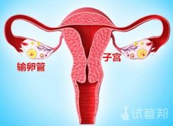 输卵管堵塞能怀孕吗？