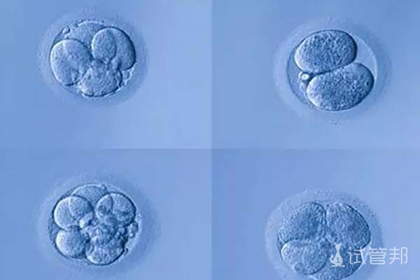 试管婴儿胚胎等级是什么意思