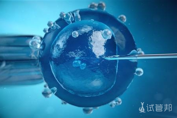 上海做试管婴儿需要预约吗