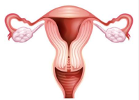 子宫内膜薄做试管婴儿会影响胚胎着床吗？