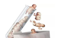 美国试管婴儿如何避免新生儿缺陷？