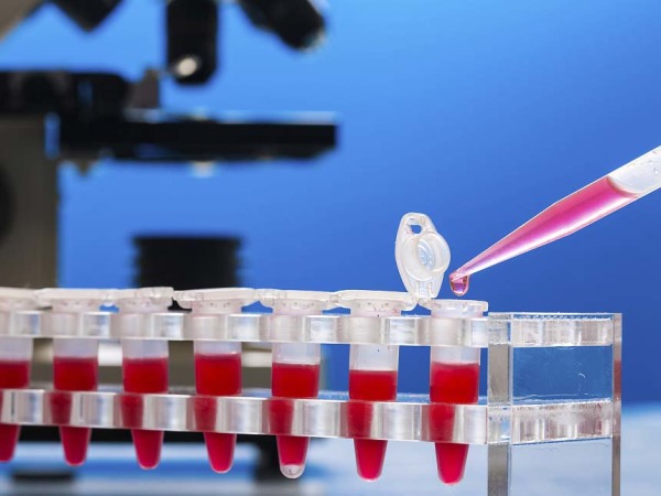 单纯疱疹病毒1型igg抗体阳性是什么意思