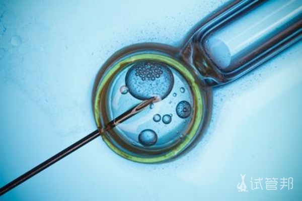 胚胎移植时期的其特点是怎样的