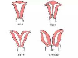 北京大学第三医院做双子宫手术值得放心吗