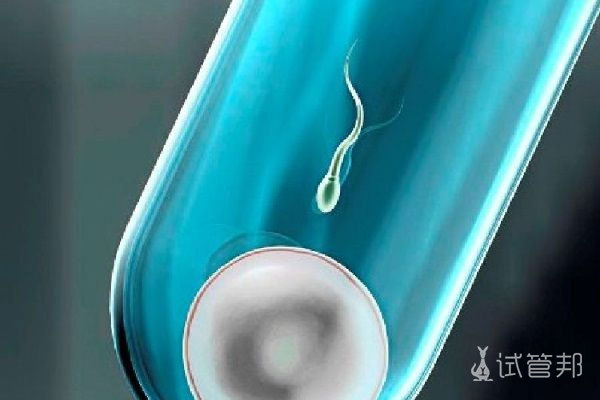 试管婴儿的成功率是多少