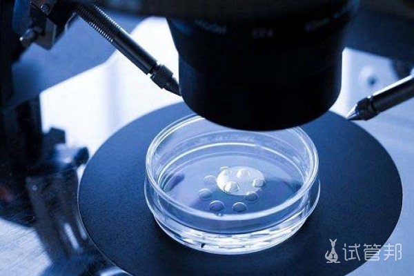 脆性x染色体综合症是什么病