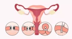 输卵管通水多久后可以怀孕？