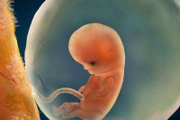 胚胎停育的原因？