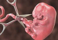 胚胎停育做药流还是做人流？