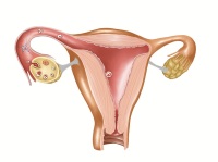 卵巢囊肿能做试管婴儿吗？