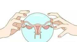 子宫纵隔有哪些症状？