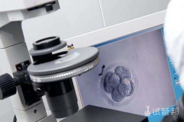 试管婴儿流程有哪些