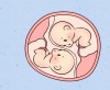 福州总医院做试管婴儿可以生龙凤胎吗？