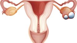 卵巢囊肿怎样预防？