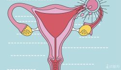卵巢囊肿怎么引起的？