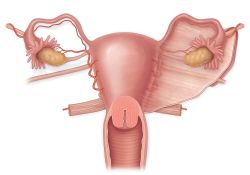卵巢癌可以怀孕吗?