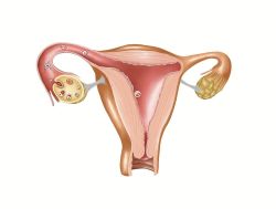 输卵管粘连术后怀孕几率大吗？