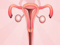 输卵管囊肿是什么原因形成的?