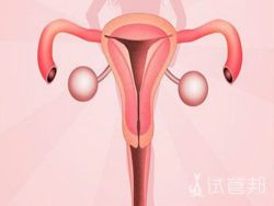 输卵管囊肿是什么原因形成的?