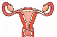 输卵管囊肿会影响怀孕吗?