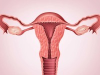 什么是子宫内膜癌？