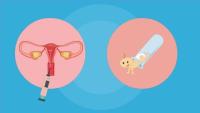 试管婴儿促排卵期间有哪些注意事项?