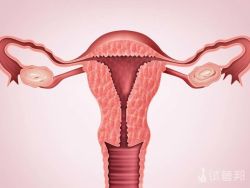 输卵管囊肿会引起输卵管堵塞吗?