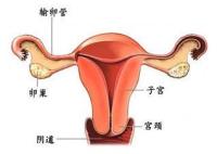 输卵管囊肿的病因是什么?