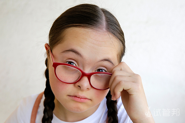 唐氏综合征发病的原因是什么