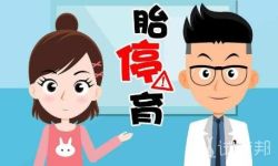 胎停育一般发生在多少周?