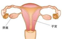 什么是卵巢囊肿?