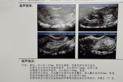 37岁做试管婴儿再当妈，感谢河北医科大学第二医院