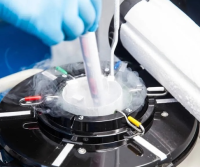 试管婴儿冻胚移植适合哪些情况?