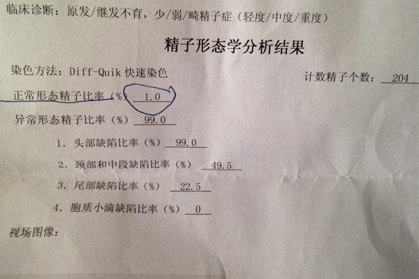 供精试管费用是多少