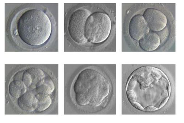 囊胚培养过程