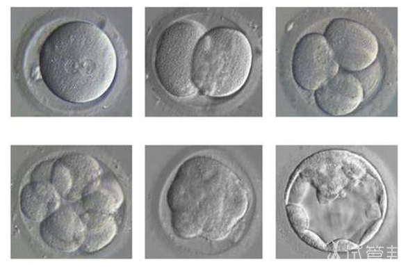 囊胚培养过程