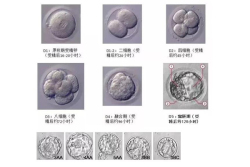 30岁试管婴儿移植失败怎么办