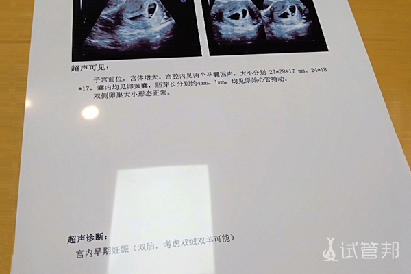 上海六院试管婴儿一次成功