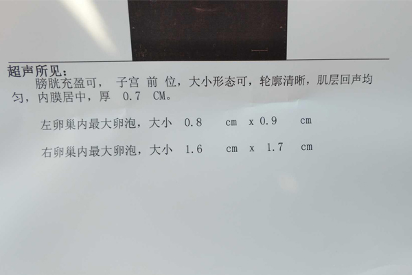 监测卵泡挂什么科