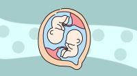 吃什么有助于怀双胞胎?