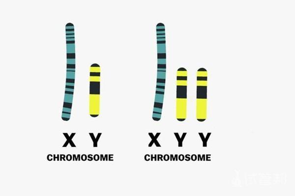 双y染色体有哪些症状