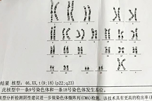 染色体异位可以做试管婴儿吗