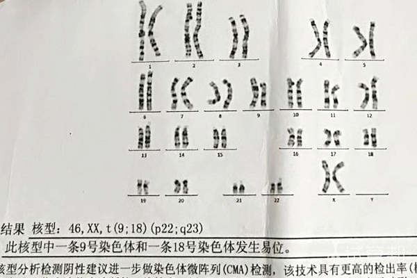 97a9ba02e6aea9b709717c7f1697d9e7.jpg 染色体异位可以做试管婴儿吗