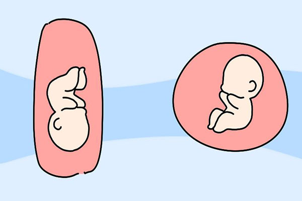 但是,孕妇要注意孕囊的形状来判断胎儿是否健康