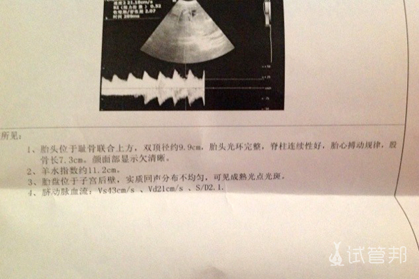 5cdec41b2f788197a9857299b1bfd863.jpg 35岁高龄试管婴儿验孕成功