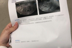 4年备孕无果，青海省妇女儿童医院试管婴儿好孕！