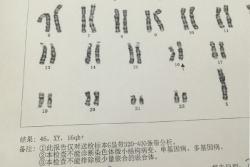 染色体问题导致试管婴儿失败2次，兰州大学第一医院做三代试管婴儿成功